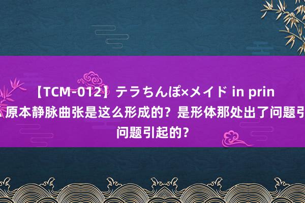 【TCM-012】テラちんぽ×メイド in prin MIKA 原本静脉曲张是这么形成的？是形体那处出了问题引起的？